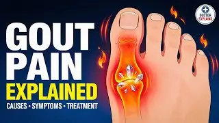 🔥 Gout Decoded 