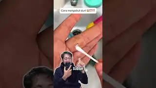 Cara mencabut duri 😱⁉️‼️ #jalanyangjauhjanganlupapulang