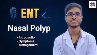Nasal polyp | Antrochoanal polyp | Ethmoidal polyp | ENT Bangla lecture