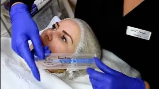 Dermaplaning Treatment using Skin Formulation Skincare Range