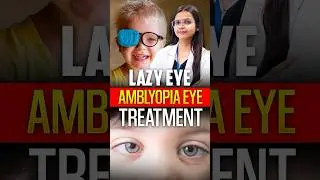 Lazy Eye (Amblyopia) Treatment in Children | Early Diagnosis & Best Eye Care
