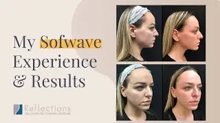 My #Sofwave Experience - 