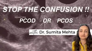 PCOD vs PCOS: Clear, Simple Answers to Common Questions
