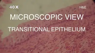 MICROSCOPIC VIEW - TRANSITIONAL EPITHELIUM