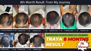 Traya hair genuine review after 8 months😎
