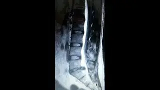 Sports Injury Orange | Chiropractic Therapy Tustin | Active Therapy Tustin