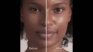 DiamondGlow Resurfacing Facial Treatment Before & After &ndash; MedSpa at CAPS