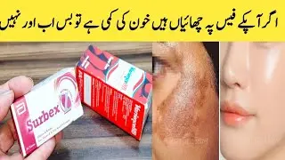 How To Remove Pigmentation || iron Syrup || Vitamin B Complex | High potancy Tablet By Maria Ansari