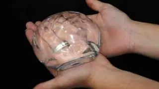 Do Breast Implants Cause Cancer?