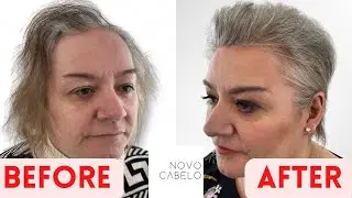 Before and After | Women’s Hair Systems Transformation | Blind Reaction