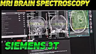 How to do MRI BRAIN SPECTROSCOPY || SPECTROSCOPY IN SIEMENS || MRI BRAI SPECTROSCOPY KAISE KRTE HAIN