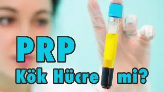 PRP Kök Hücre mi?
