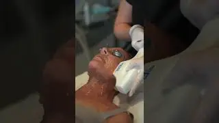 NassifMD - Before & After BBL Laser