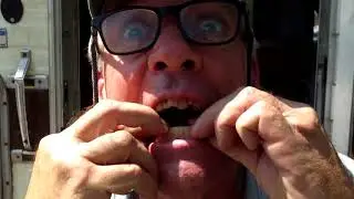 Denture Care in the Walmart parking lot redneck style!