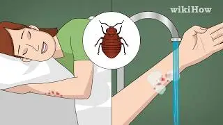 Как лечить укусы постельных клопов