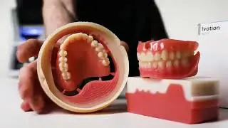 Milling Digital Dentures | VHF R5 and Ivoclar Ivotion Denture System