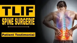 Spine Surgery Success Story | TLIF Patient Speaks.