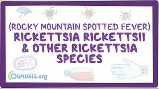 Rickettsia rickettsii & other Rickettsia species - an Osmosis Preview