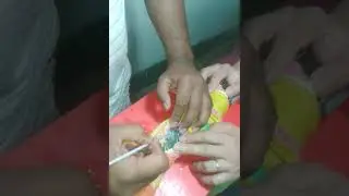 AI (Artificial Insemination) of black tiger shrimp brood stock