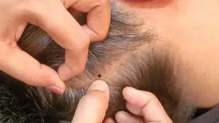 ASMR Scalp Checks: The Science of Tingles
