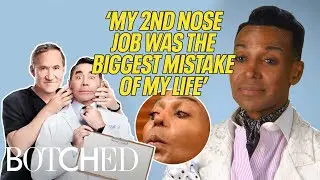 Dwight's Life TRANSFORMED After Finally Fixing His Botched Nose (Before & After) | Botched | E!