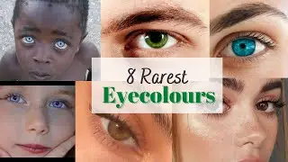 8 Rare Eye Colours That You Won't Believe Exist/ Tabu's Vogue