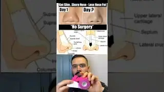 Nose taping tutorial for a button nose &ndash; does this actually work? Watch till the end.