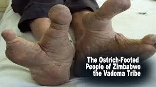 The Vadoma Tribe: The Mysterious Ostrich-Footed People of Zimbabwe