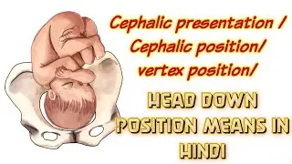 Cephalic presentation /Cephalic position/ vertex position/head down position meaning in HINDI।