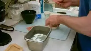 Custom Impression Tray Fabrication