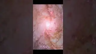 LINDA GALAXIA M83#shorts#galaxy#astronomy
