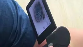 Portable Digital Microscope Dermatoscope ---operation video
