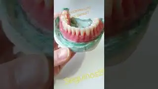 Curso de protesista dental durbanlab