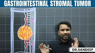 Gastrointestinal Stromal Tumor | Surgery | Bailey learned with Dr. Sandeep | PW MedEd