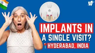 Single Visit Implants in Hyderabad, India: Here's What to Expect