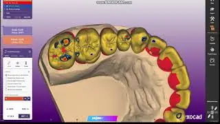 Full Arch Design in exocad #dentaltechnician  #smiledesigner #exocad