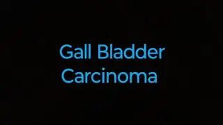 Carcinoma of  Gallbladder
