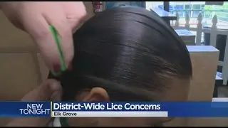 Elk Grove Lice Problems Have Parents Itching For School Policy Change