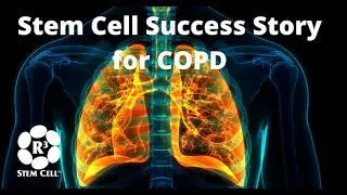 Stem Cell COPD Success Story at R3 International +1 (888) 988-0515