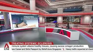 Systemic sclerosis causes 1 in 2 deaths within 4 years of diagnosis
