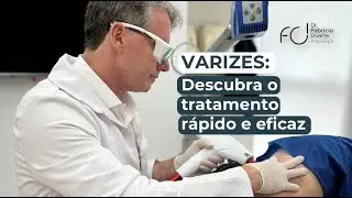 Tratamento de Varizes a Laser funciona? | Dr. Fabricio Duarte - Angiologista em Joinville