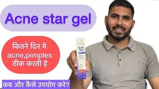 Acne star gel review in Hindi // मुहासों के लिए सर्वश्रेष्ठ जेल 