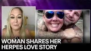 Woman with Herpes shares her love story