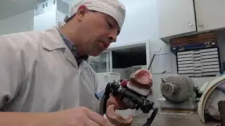 Complete denture set up in a laboratory by Eugene Shmitsman, RD.