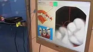 Cadent Digital Impression System