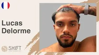 Lucas Delorme - A Hair Transplant Review with SHIFT Hair in Turkey Istanbul