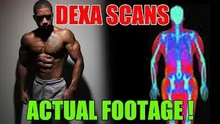 DEXA SCAN | BETTER THAN 3D BODY SCAN