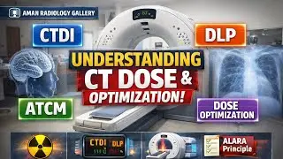CTDI, DLP & ATCM Explained | CT Dose Optimization & ALARA Principle