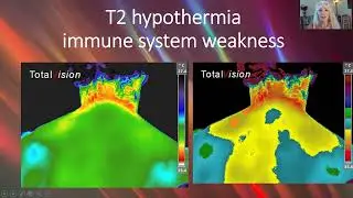 Medical Thermography