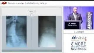 Dr  Samuel Joseph Tampa Revision Spine Surgery